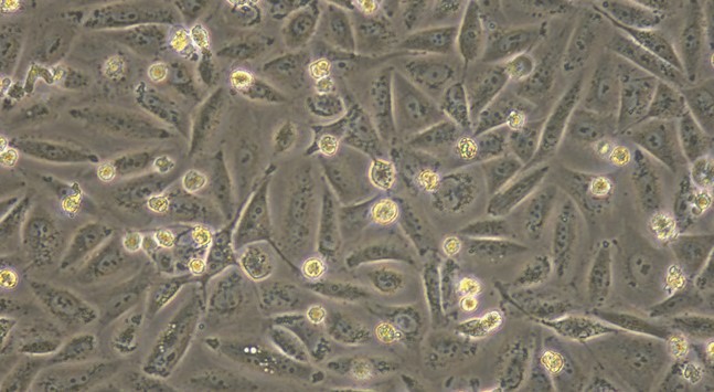 Human Renal Glomerulus Endothelial Cells (RGEC)