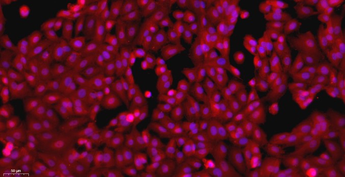 Primary Rat Renal  Tubular Epithelial Cells (RTEC)