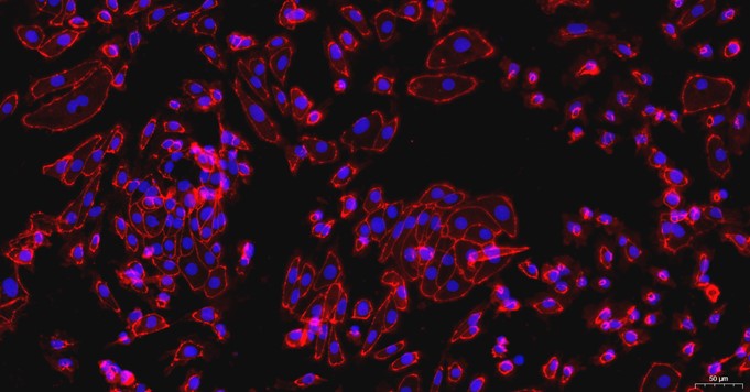 Primary Rat Renal  Tubular Epithelial Cells (RTEC)