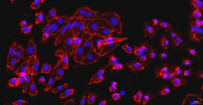 Primary Rat Renal  Tubular Epithelial Cells (RTEC)