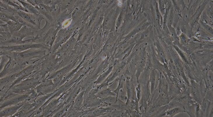 Primary Rat Bladder Smooth Muscle Cells (BSMC)