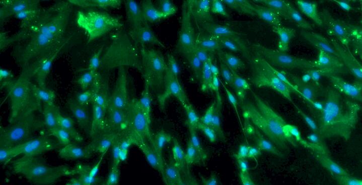 Primary Rat Bladder Smooth Muscle Cells (BSMC)