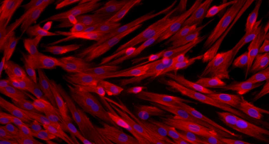 Primary Rat Bladder Stromal Fibroblasts (BSF)