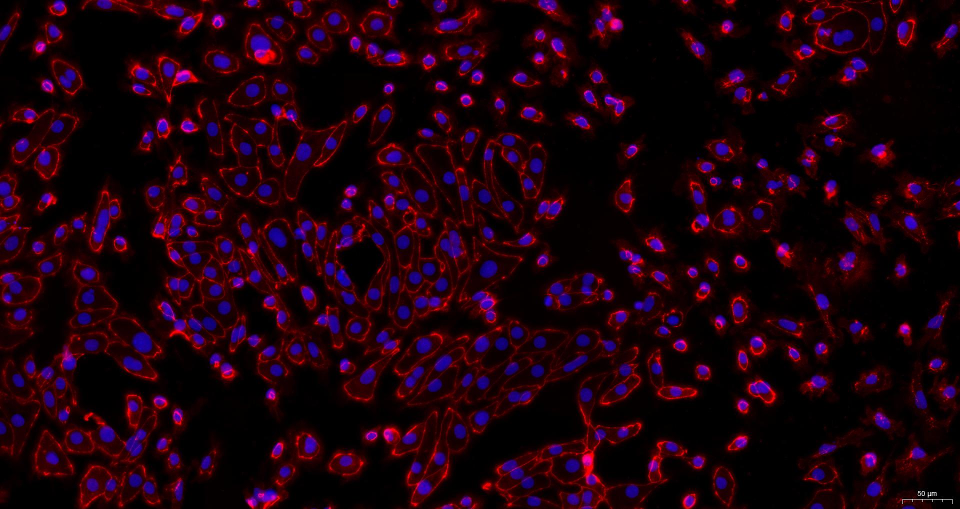 Primary Mouse Renal Cortical Epithelial Cells (RCEC)