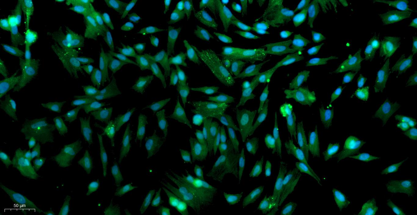 Primary Canine Tracheal Smooth Muscle Cells (TSMC)