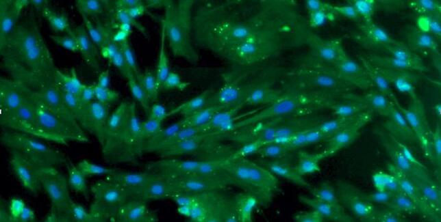 Primary Porcine Tracheal Smooth Muscle Cells (TSMC)