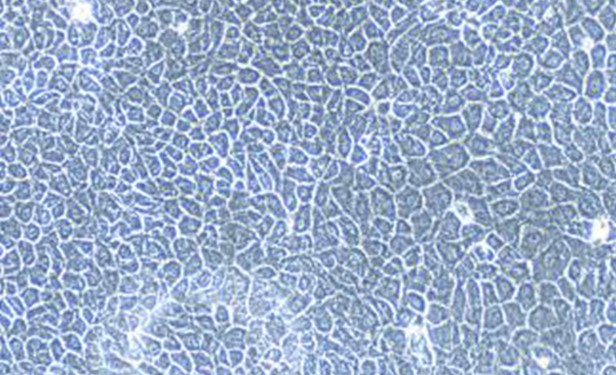 Primary Ovine Tracheal Epithelial Cells (TEC)