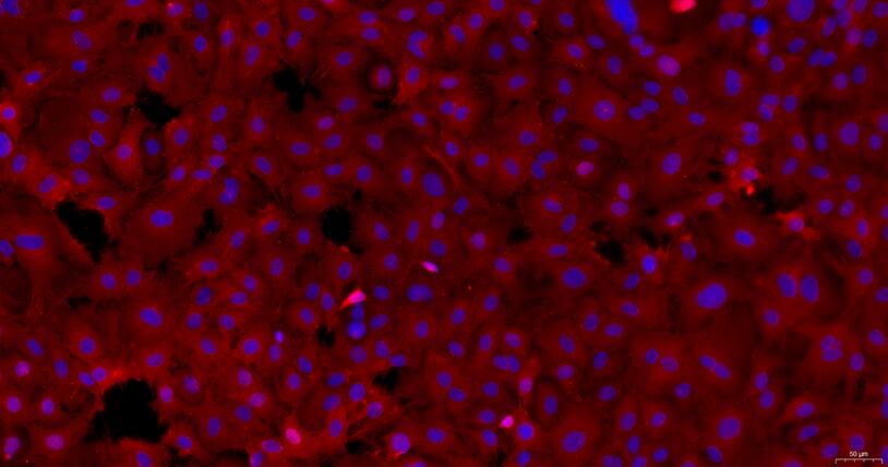 Primary Rat Tracheal Epithelial Cells (TEC)