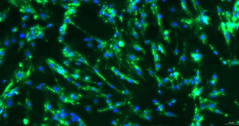 Primary Mouse Intestinal Fibroblasts (IF)