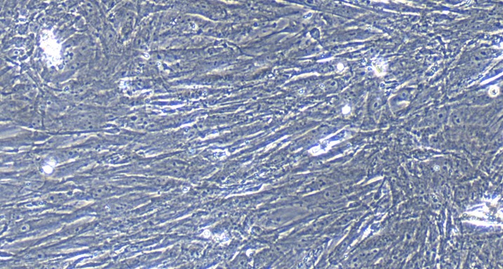 Primary Mouse Intestinal Fibroblasts (IF)