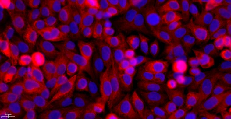 Primary Canine Neonatal Epidermal Keratinocytes (NEK)