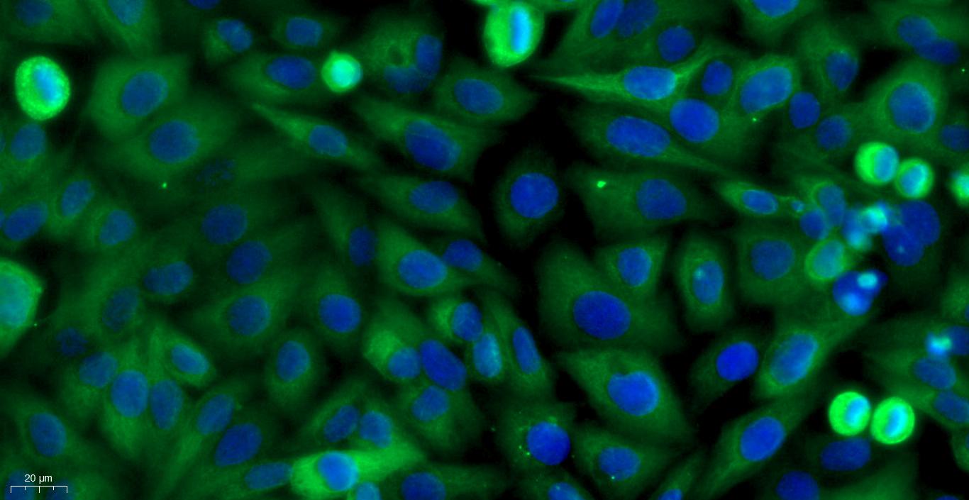 Primary Mouse Neonatal Epidermal Keratinocytes (NEK)