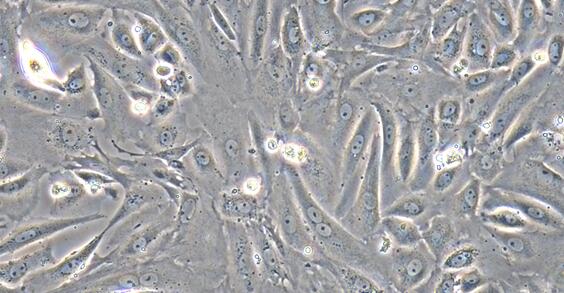 Primary Mouse Dermal Lymphatic Endothelial Cells (DLEC)