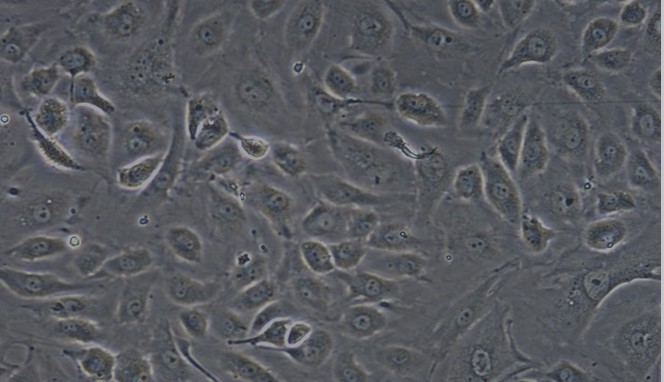 Primary Human Dermal Microvascular Endothelial Cells (DMEC)