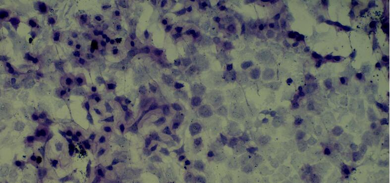 Primary Rabbit Bone Marrow-derived Mesenchymal Stem Cells (BMMSCs)