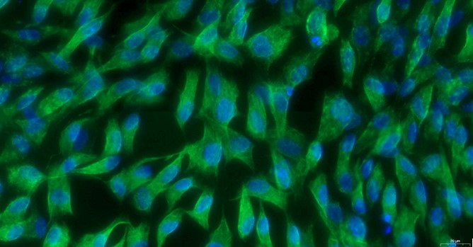 Primary Feline Adult Dermal Fibroblasts (ADF)
