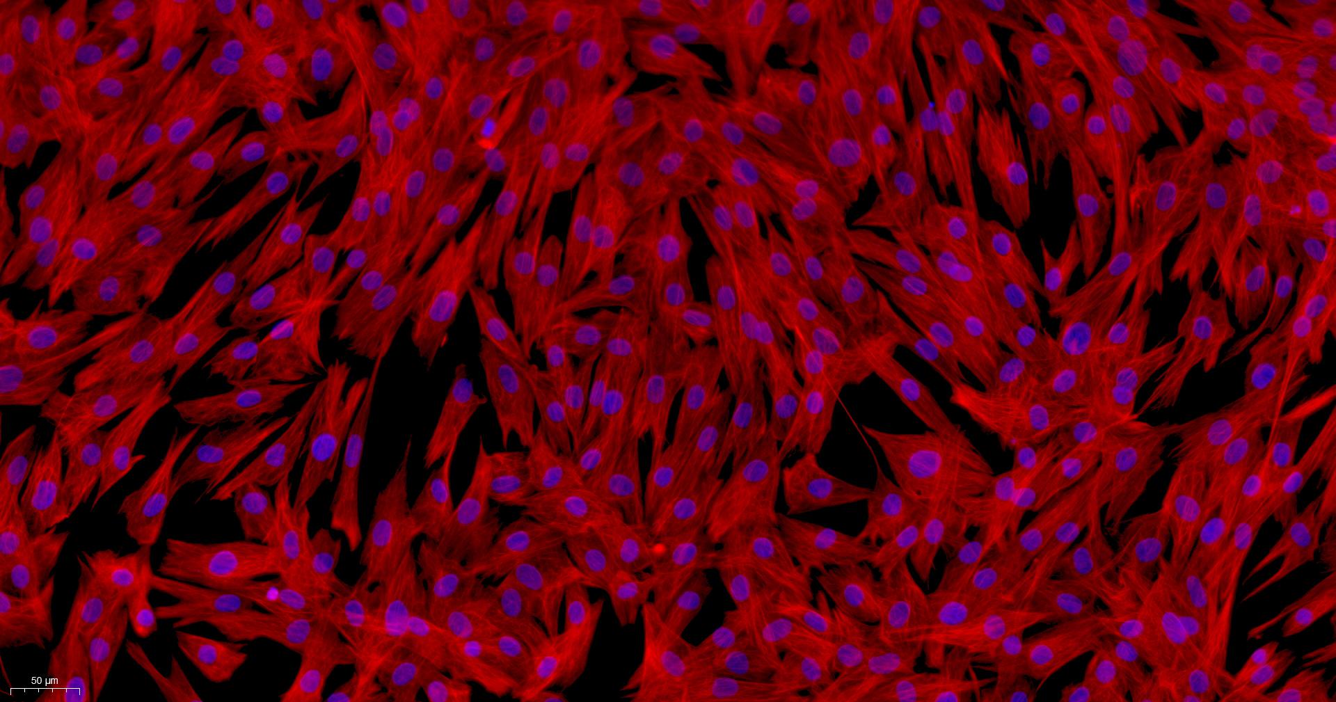 Primary Rabbit Neonatal Dermal Fibroblasts (NDF)