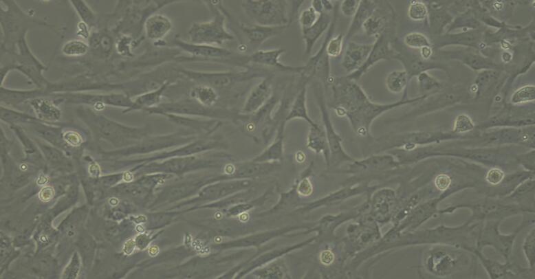 Primary Mouse Splenic Fibroblasts (SF)