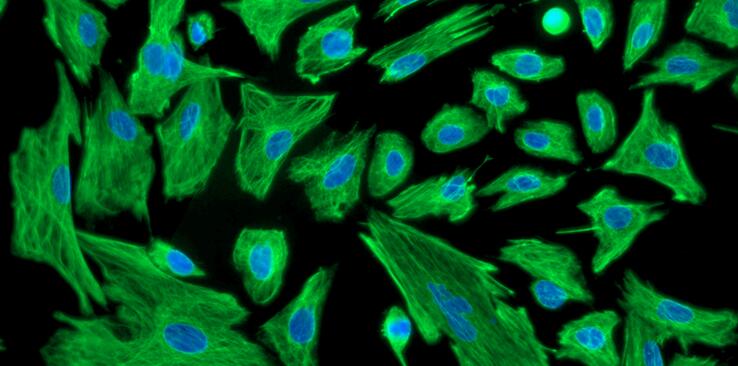 Primary Mouse Cardiac Fibroblasts (CF)