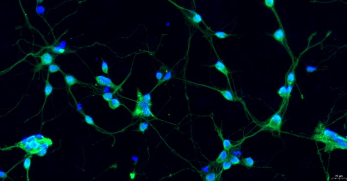 Primary Mouse Hippocampal Neuron Cells  (HNC)