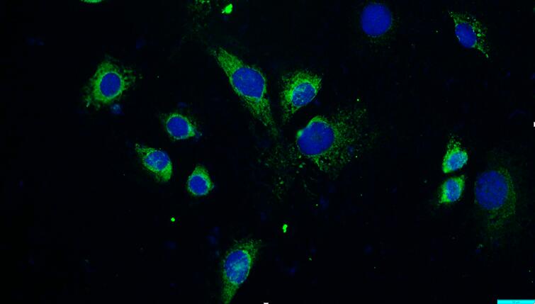 Primary Mouse Osteoblasts (OB)