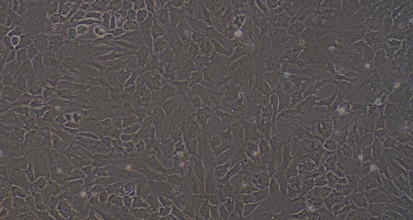 Primary Rat Osteoblasts (OB)