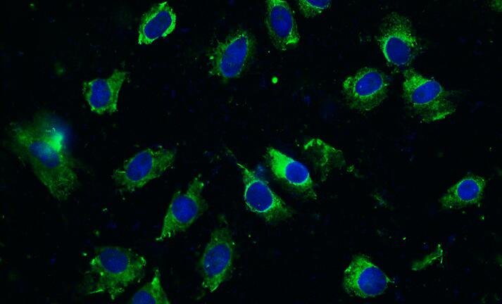 Primary Rat Osteoblasts (OB)