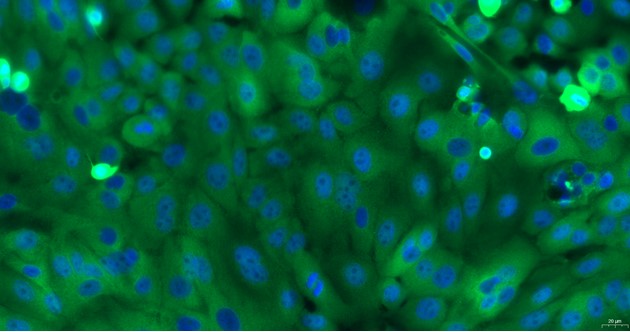 Primary Canine Esophageal Epithelial Cells (EEC)