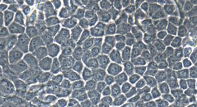 Primary Mouse Esophageal Epithelial Cells (EEC)