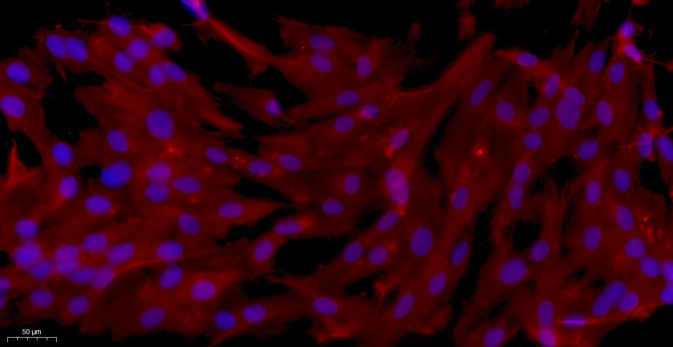 Primary Rat Esophageal Smooth Muscle Cells (ESMC)