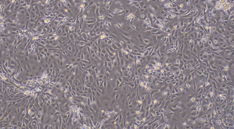 Primary Mouse Cervical Epithelial Cells (CrEC)