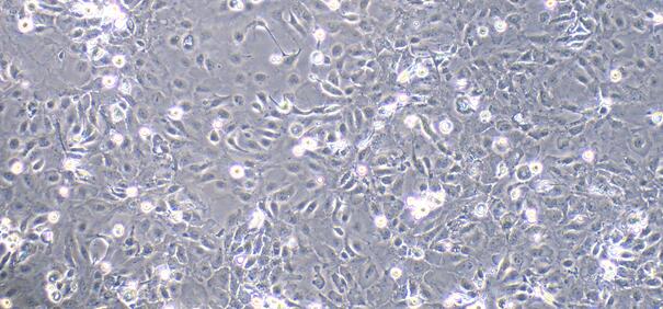 Primary Rat Cervical Epithelial Cells (CrEC)