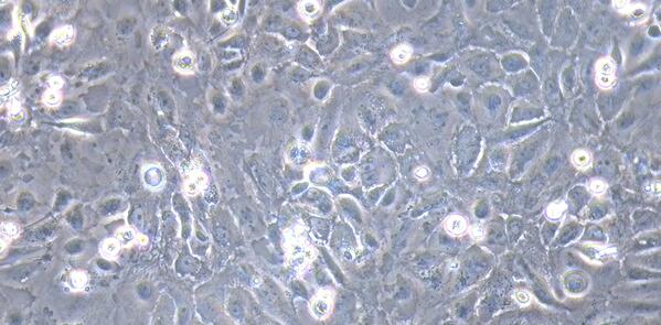 Primary Rat Cervical Epithelial Cells (CrEC)