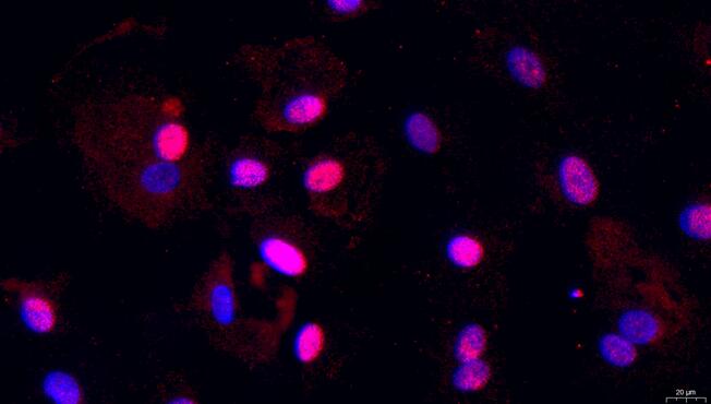 Primary Rabbit Nucleus Pulposus Cells (NPC)