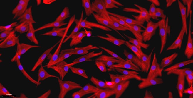 Primary Mouse Synovial Cells (SYC)