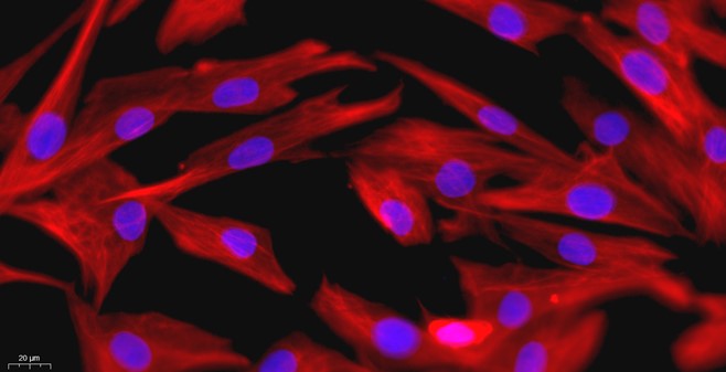 Primary Mouse Synovial Cells (SYC)