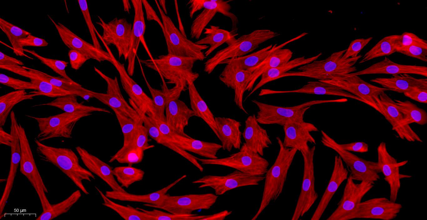 Primary Rat Synovial Cells (SYC)