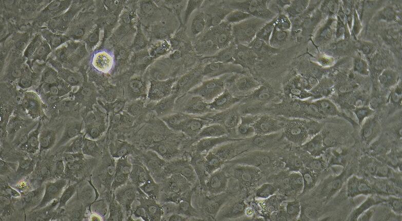 Primary Mouse Adipose Microvascular Endothelial Cells (AMEC)