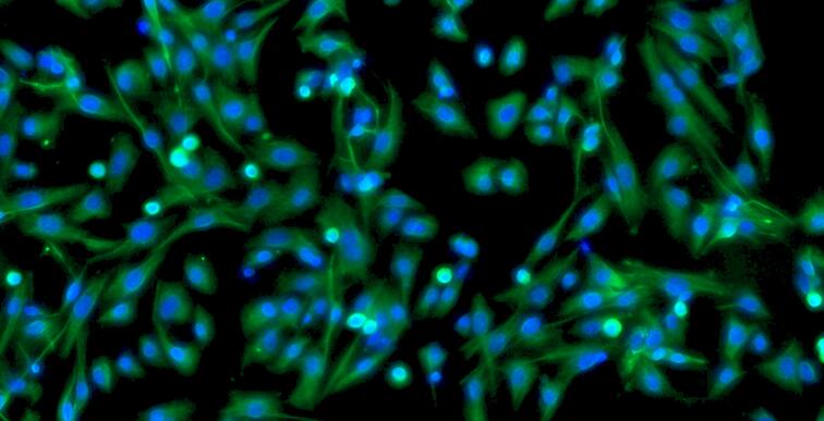 Primary Mouse Adipose Microvascular Endothelial Cells (AMEC)