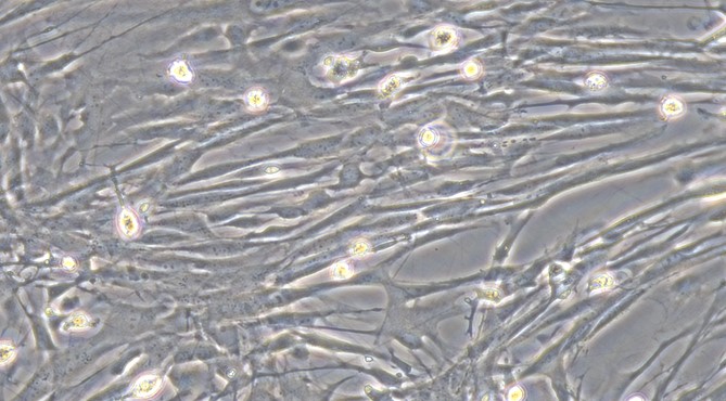 Primary Canine Brain Vascular Pericytes (BVP)