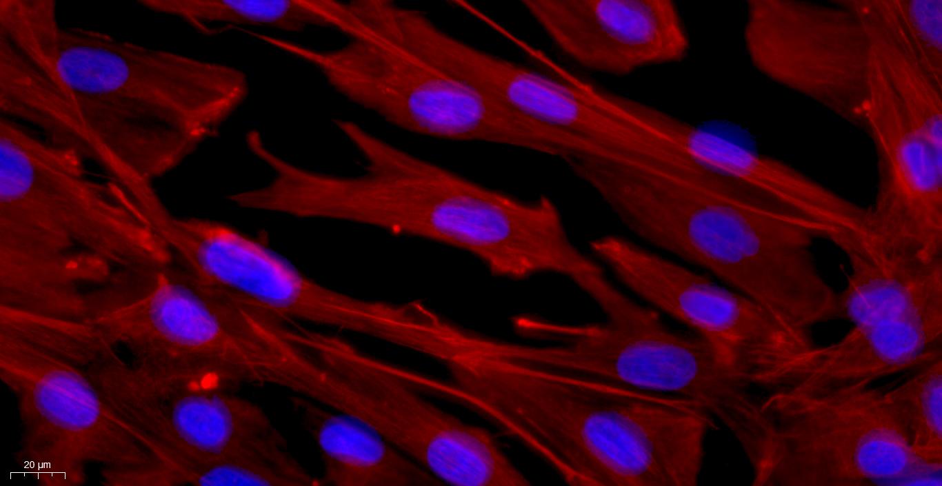 Primary Caprine Ovarian Fibroblasts (OF)