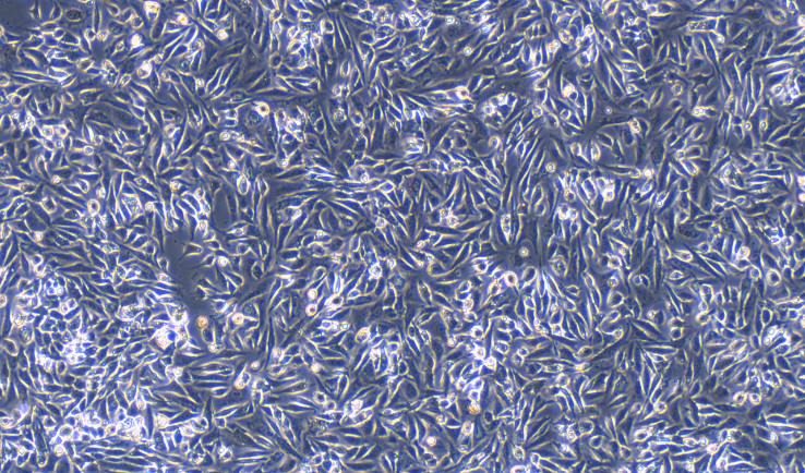 Primary Mouse Ovarian Surface Epithelial Cells (OSEC)