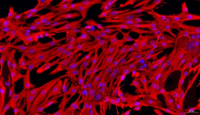 Primary Rabbit Prostate Fibroblasts (PF)