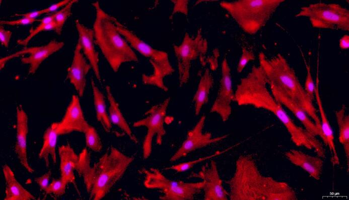 Primary Rat Pancreatic Stellate Cells (PaSC)