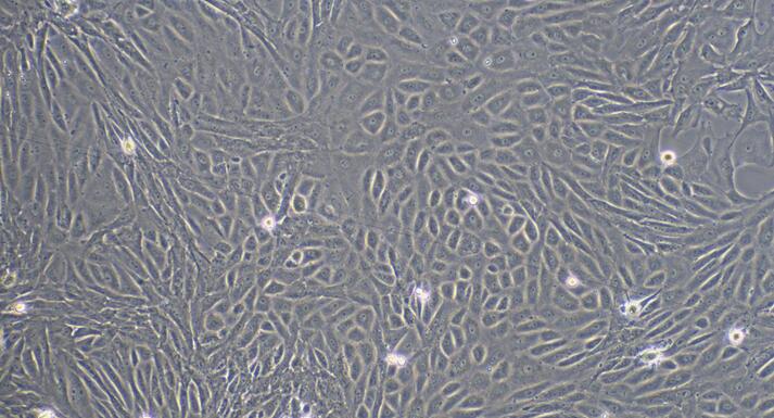 Primary Rabbit Retinal Pigment Epithelial Cells (RPEC)