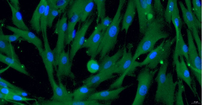 Primary Cavia Aortic Smooth Muscle Cells (ASMC)