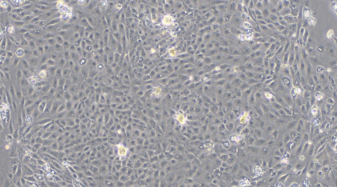 Primary Mouse Seminal Vesicle Epithelial Cells (SVEC)
