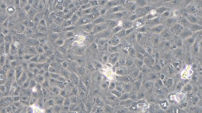 Primary Mouse Seminal Vesicle Epithelial Cells (SVEC)