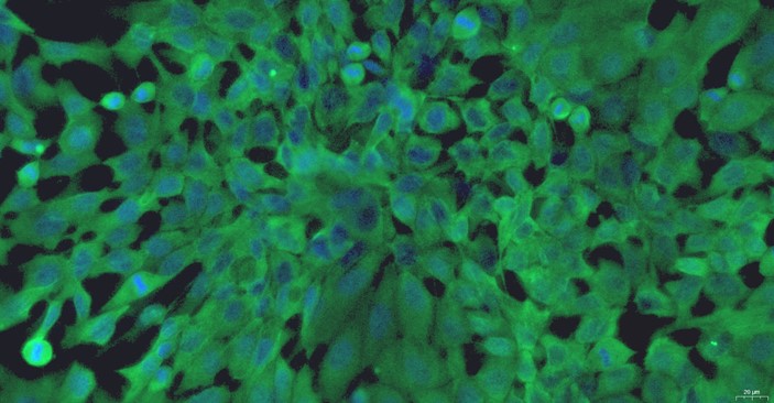 Primary Canine Prostate Epithelial Cells (PrEC)