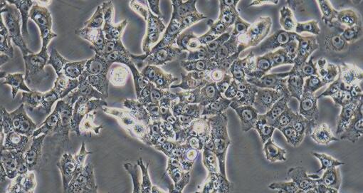 Mouse Hepatocellular Carcinoma Cells (HCC)